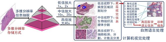 说明:图11